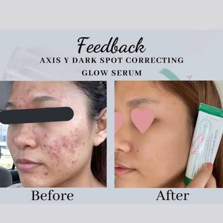 Axis-Y Dark Spot Correcting Glow Serum 50ml