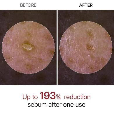 Black Peel Shot – Deep Exfoliating Serum (80ml)