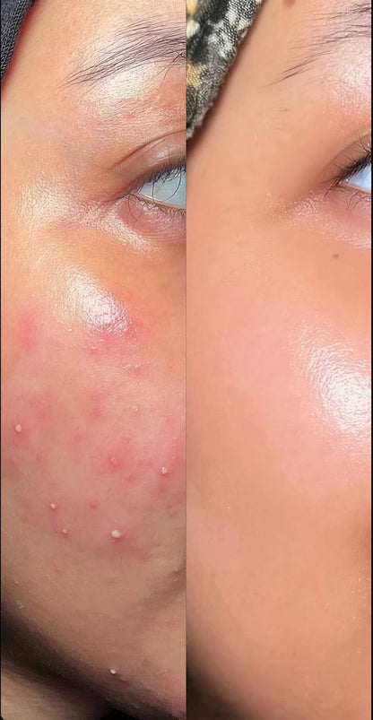 Axis-Y Dark Spot Correcting Glow Serum 50ml